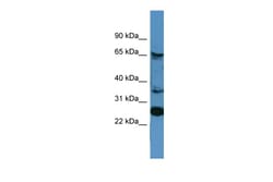 Aviva Systems Biology Corp CANX Antibody - C-terminal region (ARP59755_P050)