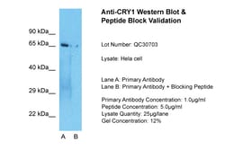 Aviva Systems Biology Corp CRY1 Antibody - N-terminal region (ARP59758_P050)
