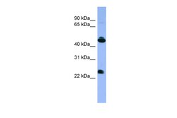 Aviva Systems Biology Corp OPN1MW Antibody - C-terminal region (ARP59764_P050)