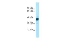 Aviva Systems Biology Corp Olfr329-ps Antibody - middle region (ARP59825_P050)