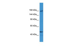 Aviva Systems Biology Corp BTBD12 Antibody - N-terminal region (ARP59857_P050)