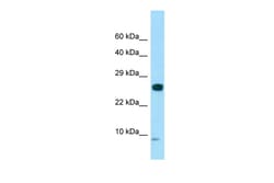 Aviva Systems Biology Corp SPANXC Antibody - N-terminal region (ARP59900_P050)