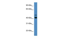 Aviva Systems Biology Corp OPN1SW Antibody - C-terminal region (ARP59911_P050)