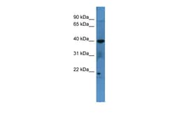 Aviva Systems Biology Corp MRGPRX3 Antibody - C-terminal region (ARP59923_P050)