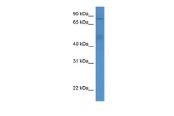 Aviva Systems Biology Corp ADD3 Antibody - middle region (ARP59947_P050)