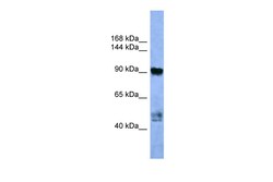 Aviva Systems Biology Corp AP2A2 Antibody - C-terminal region (ARP59974_P050)