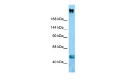 Aviva Systems Biology Corp Col11a1 Antibody - middle region (ARP60014_P050)