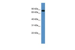Aviva Systems Biology Corp COL9A3 Antibody - C-terminal region (ARP60028_P050)