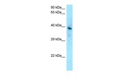 Aviva Systems Biology Corp F2RL1 Antibody - C-terminal region (ARP60034_P050)