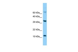 Aviva Systems Biology Corp Fabp5 Antibody - C-terminal region (ARP60048_P050)