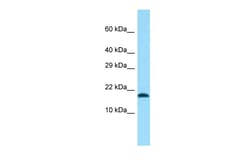 Aviva Systems Biology Corp Tmem50b Antibody - N-terminal region (ARP60093_P050)