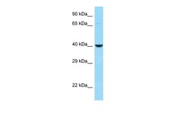 Aviva Systems Biology Corp CTSE Antibody - N-terminal region (ARP60124_P050)