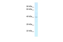 Aviva Systems Biology Corp CTSE Antibody - C-terminal region (ARP60125_P050)