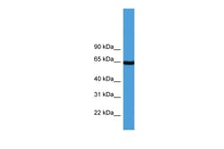 Aviva Systems Biology Corp ASNS Antibody - C-terminal region (ARP60203_P050)
