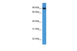 Aviva Systems Biology Corp OSBP Antibody - C-terminal region (ARP60212_P050)