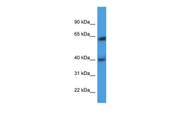 Aviva Systems Biology Corp ARPM1 Antibody - N-terminal region (ARP60227_P050)