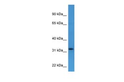 Aviva Systems Biology Corp DOK4 Antibody - C-terminal region (ARP60242_P050)