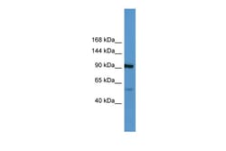 Aviva Systems Biology Corp LPA Antibody - middle region (ARP60281_P050)