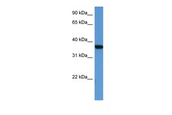 Aviva Systems Biology Corp MAPKAPK2 Antibody - middle region (ARP60320_P050)