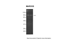 Aviva Systems Biology Corp MARCKS Antibody - C-terminal region (ARP60326_P050)