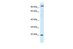 Aviva Systems Biology Corp POLR3GL Antibody - C-terminal region (ARP60451_P050)
