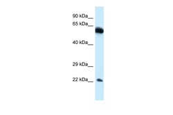 Aviva Systems Biology Corp NICN1 Antibody - middle region (ARP60478_P050)
