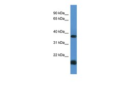 Aviva Systems Biology Corp RHBDD1 Antibody - C-terminal region (ARP60503_P050)