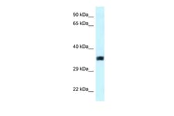 Aviva Systems Biology Corp SLC25A33 Antibody - middle region (ARP60511_P050)