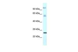 Aviva Systems Biology Corp TMEM222 Antibody - C-terminal region (ARP60516_P050)