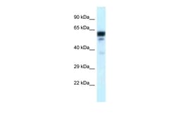 Aviva Systems Biology Corp TUBA1C Antibody - C-terminal region (ARP60614_P050)
