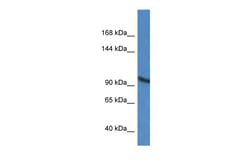 Aviva Systems Biology Corp ZMIZ2 Antibody - middle region (ARP60635_P050)