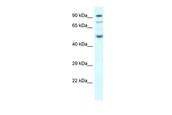 Aviva Systems Biology Corp SESN2 Antibody - C-terminal region (ARP60638_P050)