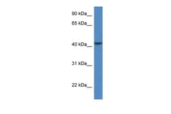 Aviva Systems Biology Corp CAB39L Antibody - N-terminal region (ARP60758_P050)