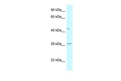Aviva Systems Biology Corp FUT8 Antibody - N-terminal region (ARP60784_P050)
