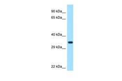 Aviva Systems Biology Corp PECR Antibody - C-terminal region (ARP60839_P050)