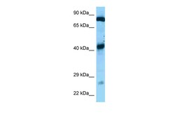 Aviva Systems Biology Corp Gfm1 Antibody - C-terminal region (ARP60908_P050)