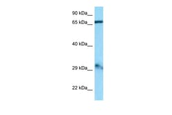 Aviva Systems Biology Corp Gfm1 Antibody - middle region (ARP60909_P050)