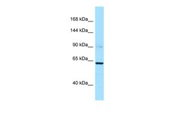 Aviva Systems Biology Corp CAPN3 Antibody - C-terminal region (ARP60946_P050)