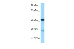 Aviva Systems Biology Corp Stx7 Antibody - N-terminal region (ARP61121_P050)