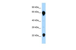 Aviva Systems Biology Corp RAG2 Antibody - C-terminal region (ARP61131_P050)