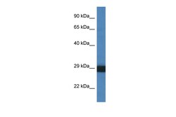 Aviva Systems Biology Corp CTSG Antibody - C-terminal region (ARP61136_P050)