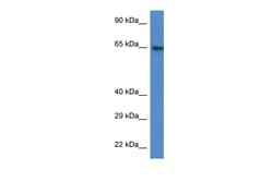 Aviva Systems Biology Corp ACSS2 Antibody - N-terminal region (ARP61137_P050)