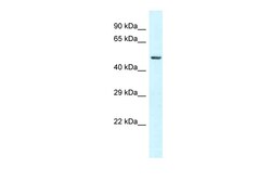 Aviva Systems Biology Corp GC Antibody - N-terminal region (ARP61150_P050)