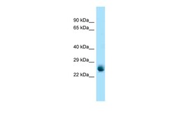 Aviva Systems Biology Corp Rab5a Antibody - middle region (ARP61182_P050)