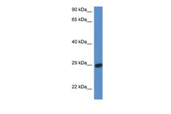 Aviva Systems Biology Corp STX2 Antibody - N-terminal region (ARP61202_P050)