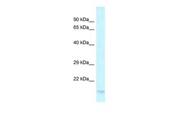 Aviva Systems Biology Corp LY96 Antibody - C-terminal region (ARP61217_P050)