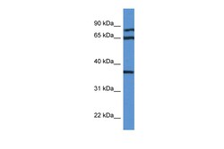 Aviva Systems Biology Corp DHPS Antibody - N-terminal region (ARP61225_P050)
