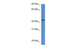 Aviva Systems Biology Corp DDO Antibody - N-terminal region (ARP61286_P050)