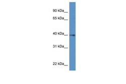 Aviva Systems Biology Corp PTGDR Antibody - C-terminal region (ARP61296_P050)