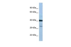 Aviva Systems Biology Corp PTGDR Antibody - C-terminal region (ARP61297_P050)